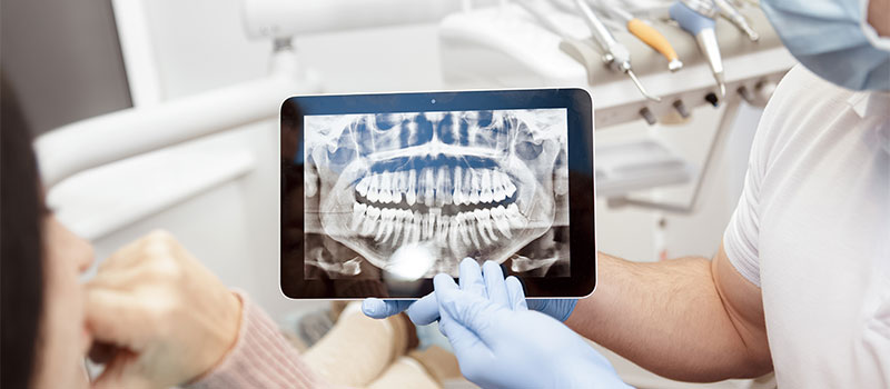 Dental X-Rays/Radiographs at Hometown Dental in Edgewater, FL