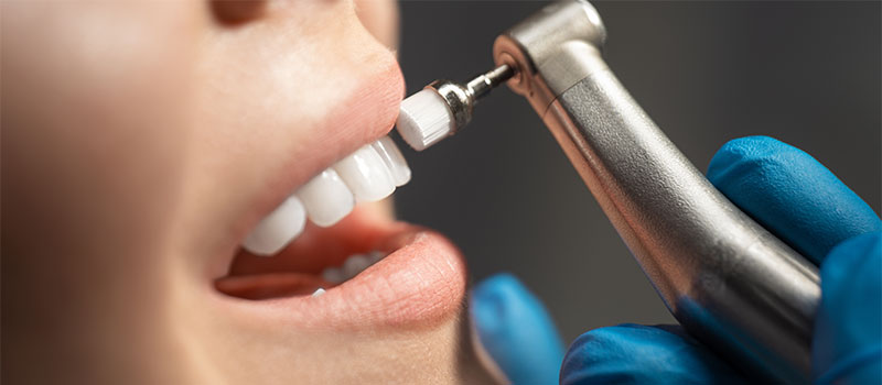 Dental Cleanings at Hometown Dental in Edgewater, FL